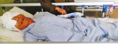 广东老人住院期间双眼被挖 院方称系自残